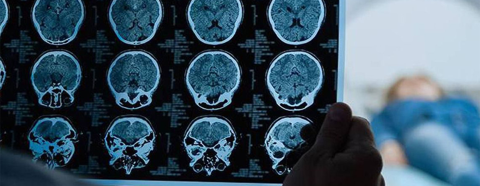 مهاجرت کاری و تحصیلی با رشته ی رادیولوژی در 2026